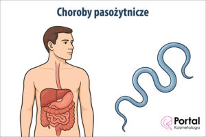 Choroby pasożytnicze