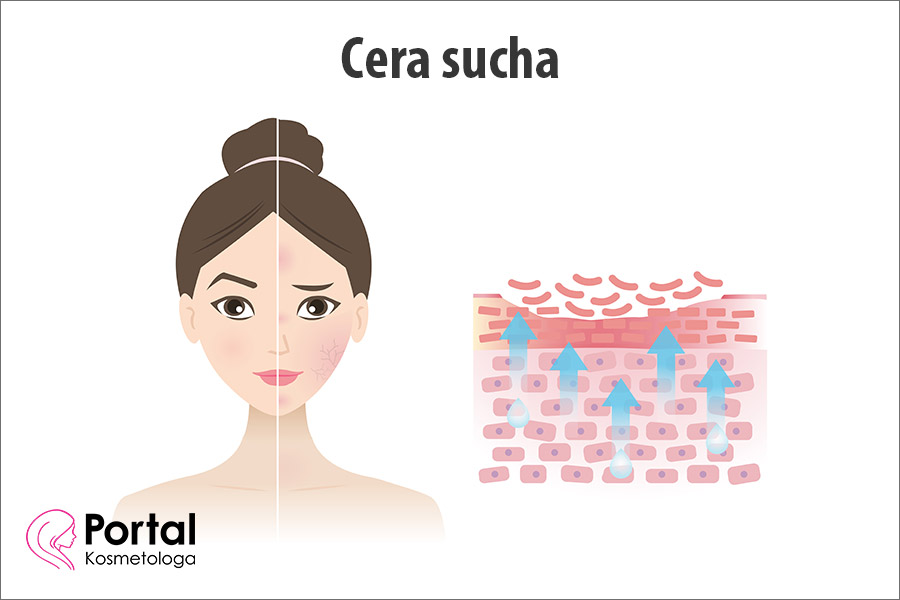 Cera sucha Cera sucha