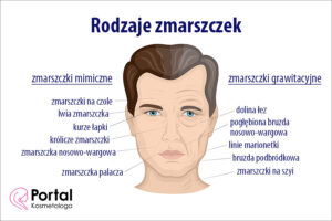 Rodzaje zmarszczek