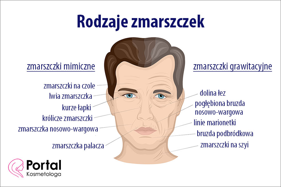 Rodzaje zmarszczek