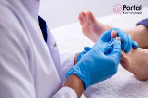 Grzybica stóp - przyczyny, objawy, leczenie