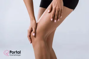 Kolana koślawe - charakterystyka