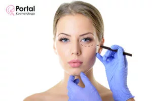 Opadające powieki - przyczyny i leczenie