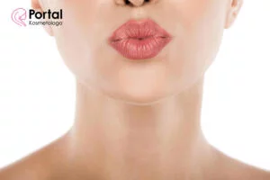 Spierzchnięte usta - jak o nie dbać?