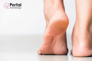 Pęknięcia i rozpadliny - przyczyny, objawy, leczenie