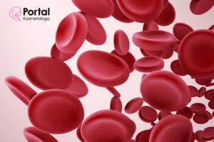 Teleangiektazje - przyczyny i leczenie