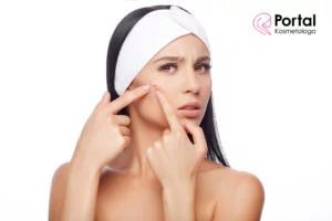 Grudki na twarzy - rodzaje, przyczyny