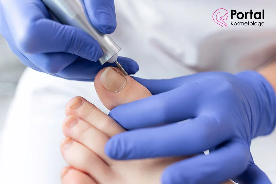 Rekonstrukcja paznokcia