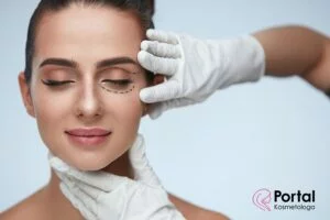 Korekcja powiek (blefaroplastyka)