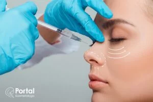 Nici Aptos - niechirurgiczny lifting twarzy