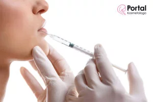 Wypełnianie zmarszczek materiałem nietrwałym