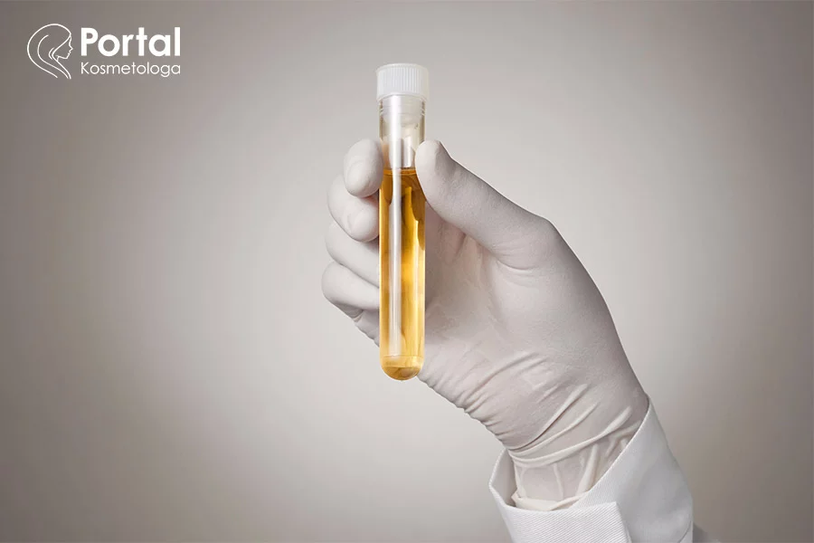 Badanie moczu - analiza