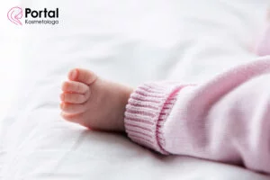 Potówki u niemowlaka - przyczyny, objawy, leczenie