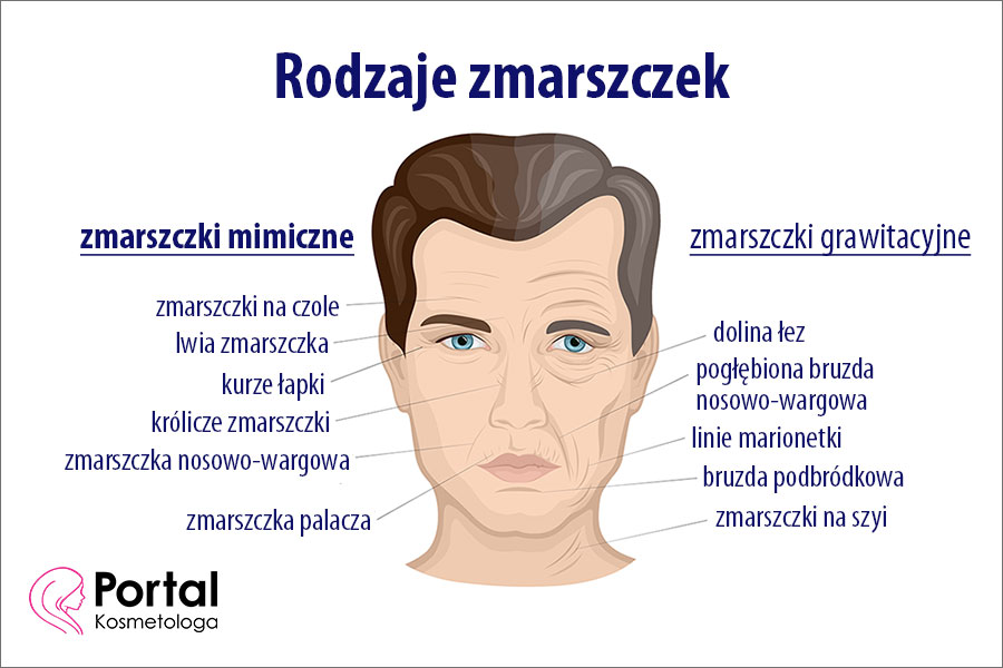 Zmarszczki mimiczne