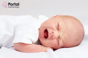 Kolka u niemowląt