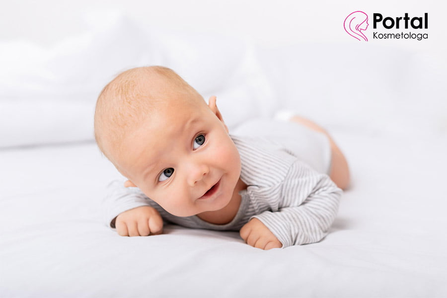 Trądzik niemowlęcy - przyczyny, objawy, leczenie