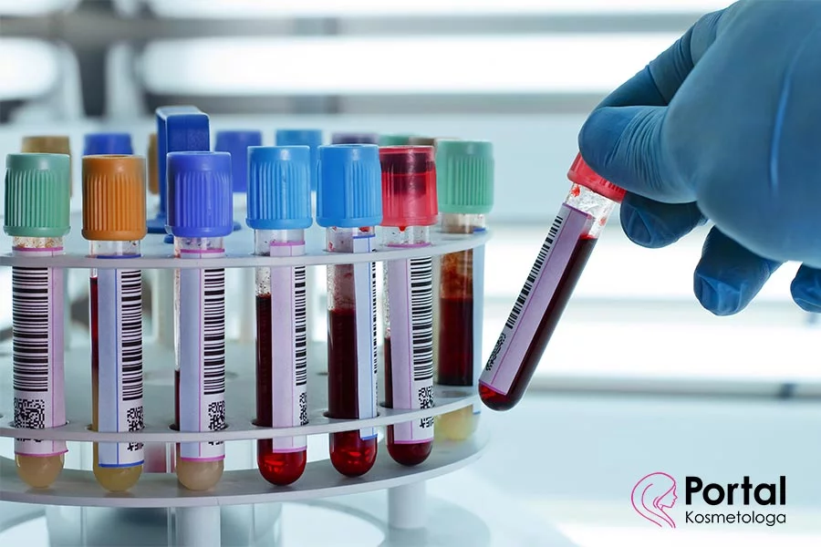 Konflikt serologiczny Koflikt serologiczny