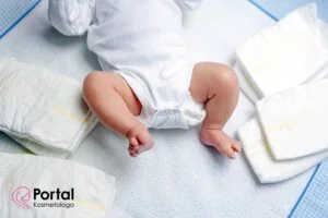 Smółka - czym jest?