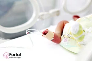 Wcześniak - przyczyny i objawy