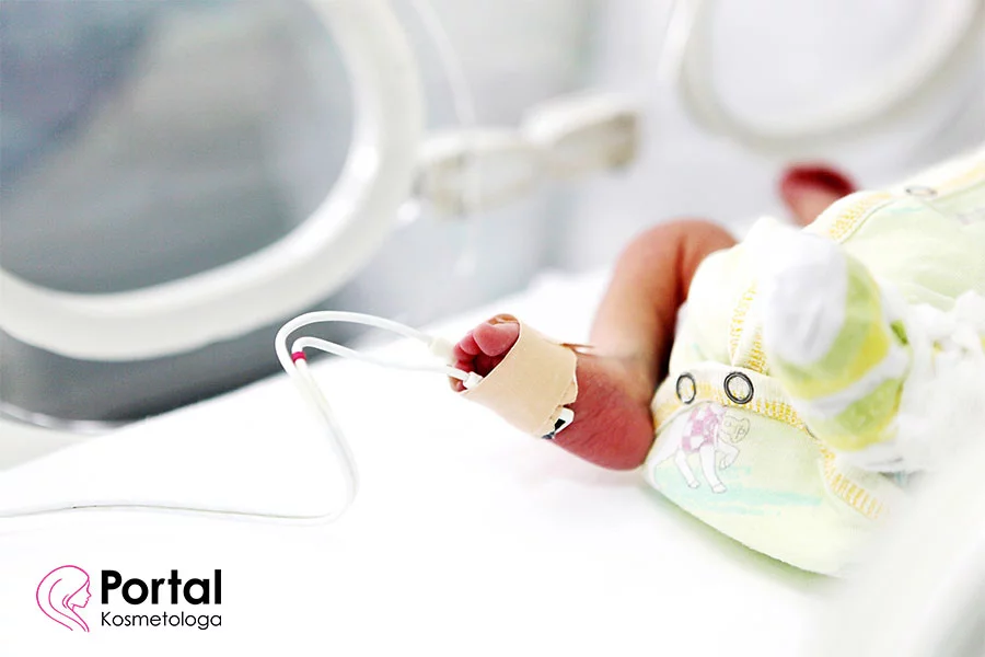 Wcześniak - przyczyny i objawy