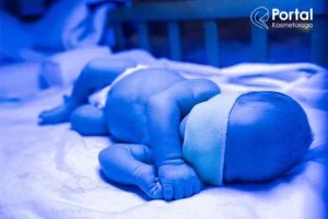 Żółtaczka u noworodków