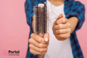 Łysienie plackowate