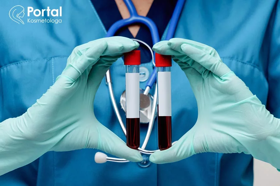 Morfologia krwi Mofologia krwi