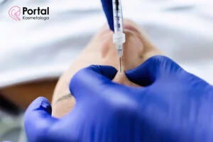 Toksyna botulinowa w medycynie estetycznej
