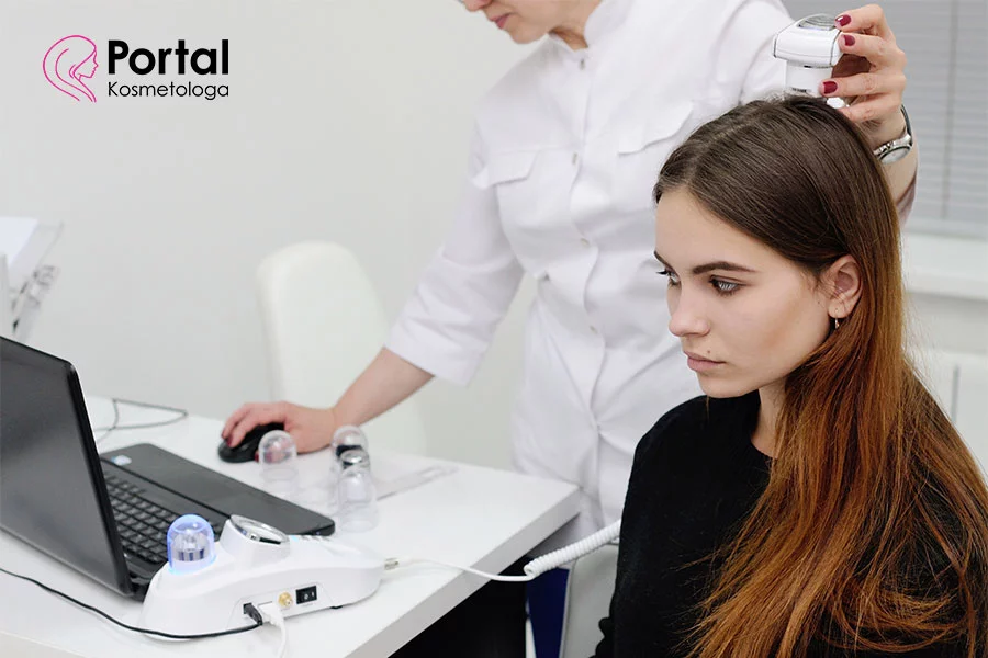 Demodekoza Demodekoza