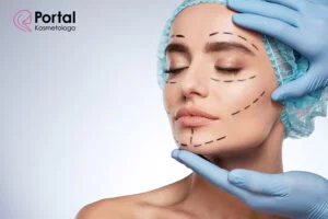 Plazma w blefaroplastyce