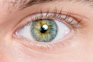 Czy odpowiednia higiena powiek może wesprzeć profilaktykę i leczenie schorzeń oczu?