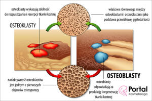 Osteoblasty