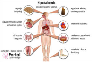 Hipokalcemia (obniżone stężenie wapnia)