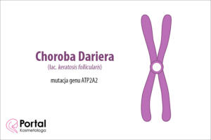 choroba Dariera