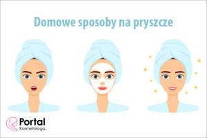 Domowe sposoby na pryszcze