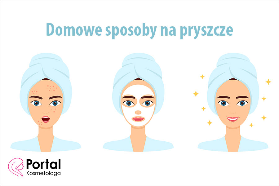 Domowe sposoby na pryszcze