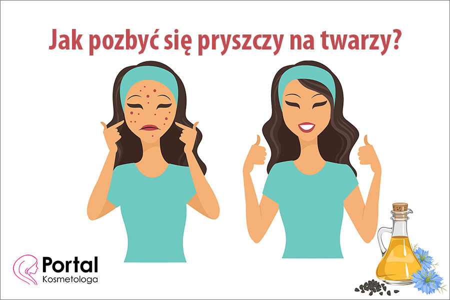 Jak pozbyć się pryszczy na twarzy?