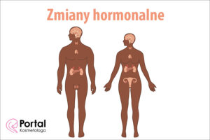 Zmiany hormonalne