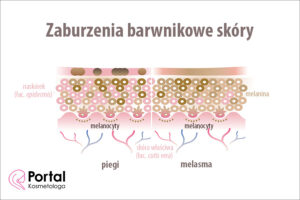 Zaburzenia barwnikowe skóry