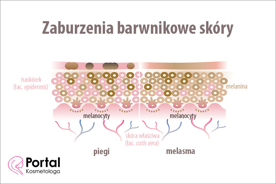 Zaburzenia barwnikowe skóry