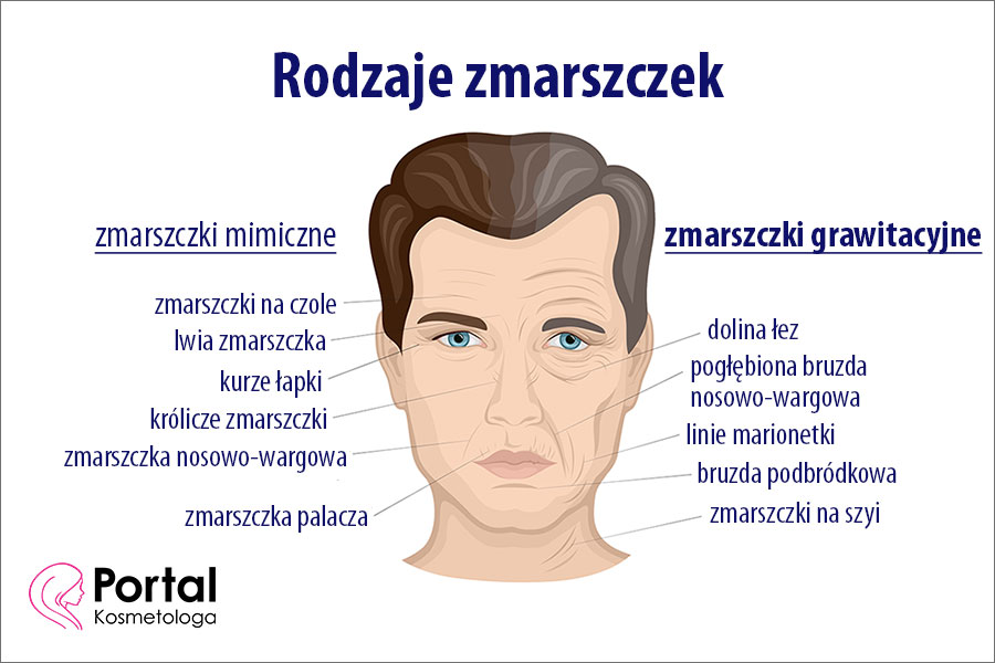 Zmarszczki grawitacyjne