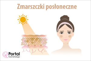 Zmarszczki posłoneczne