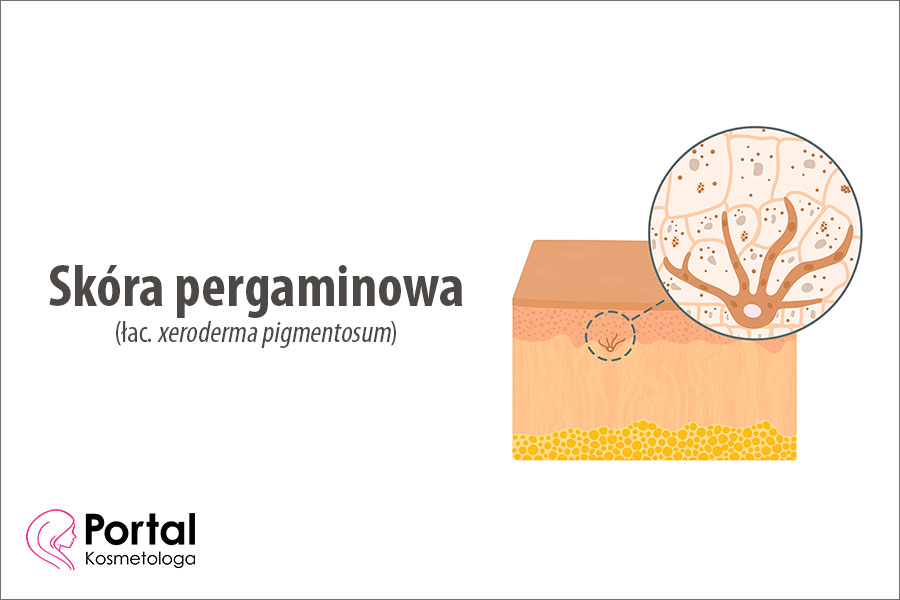 Skóra pergaminowa