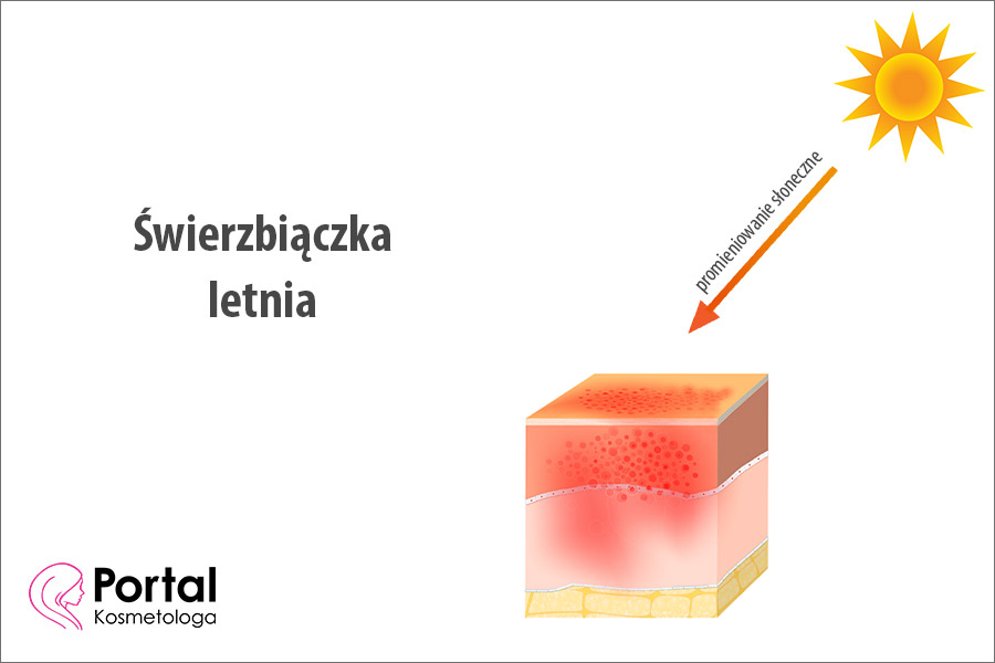 Świerzbiączka letnia