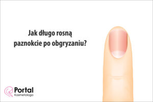 Jak długo rosną paznokcie po obgryzaniu?