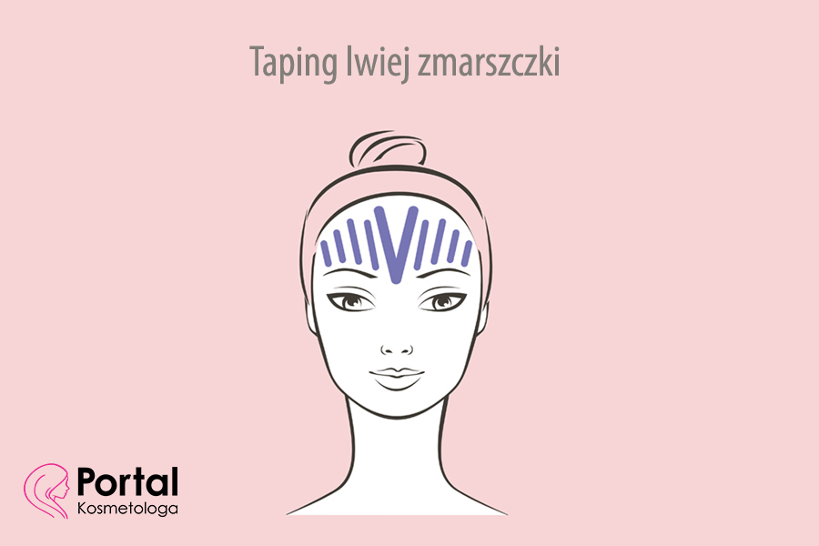 Taping lwiej zmarszczki