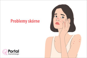 Problemy skórne