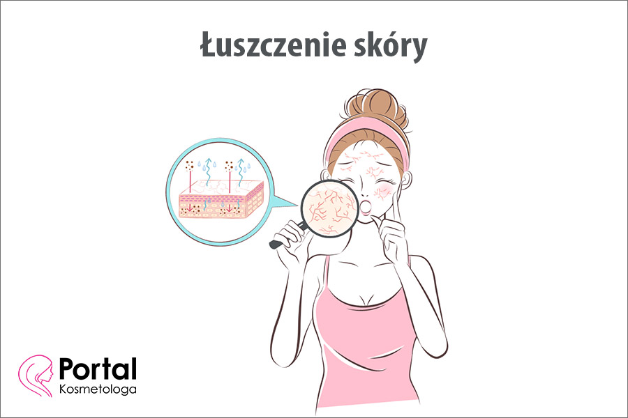 Łuszczenie skóry