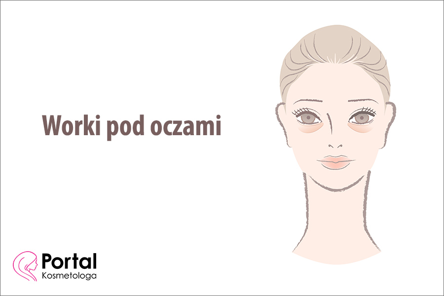 Worki pod oczami