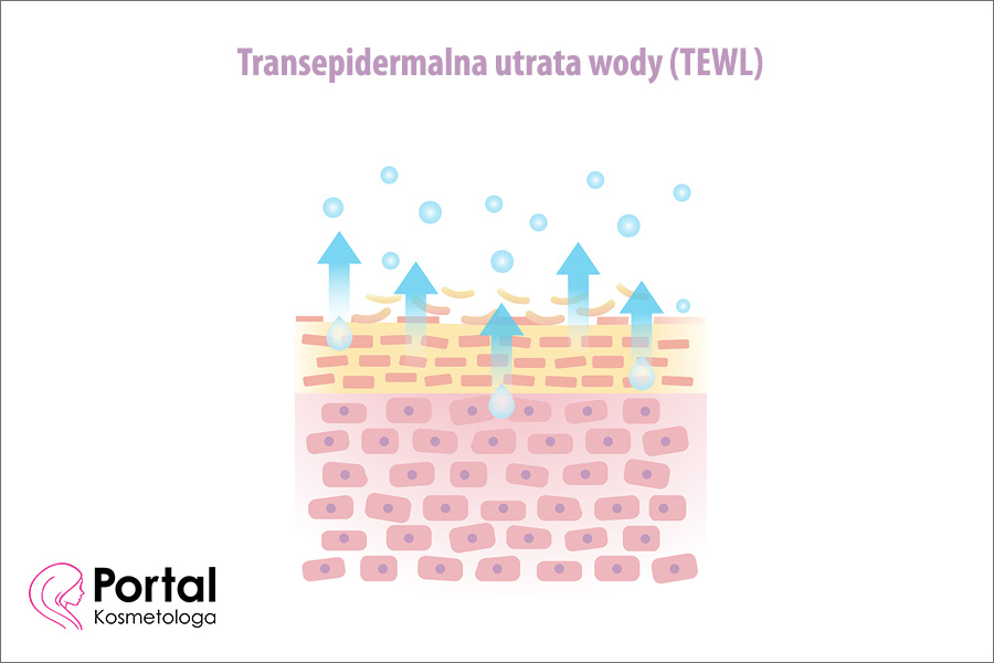 Transepidermalna utrata wody
